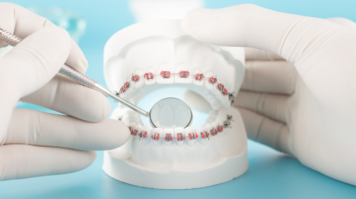 矯正治療Orthodontics